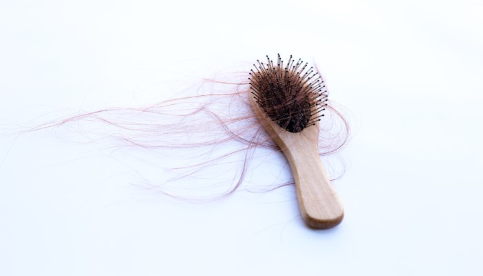 comb with lot of hairs showing hair fall or hair loss