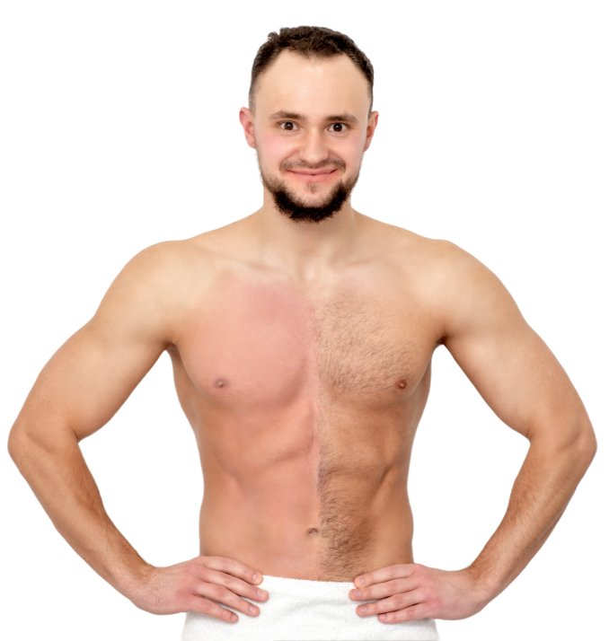 laser hair removal reduction for men
