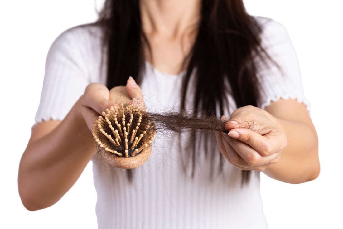Women showing comb with excess hair fall or hair loss