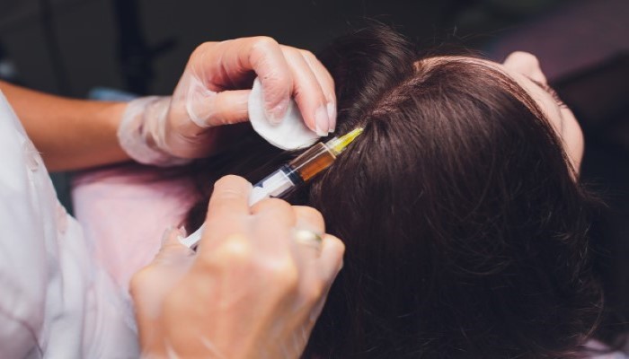 injecting gfc into scalp to control hair loss and promote hair growth
