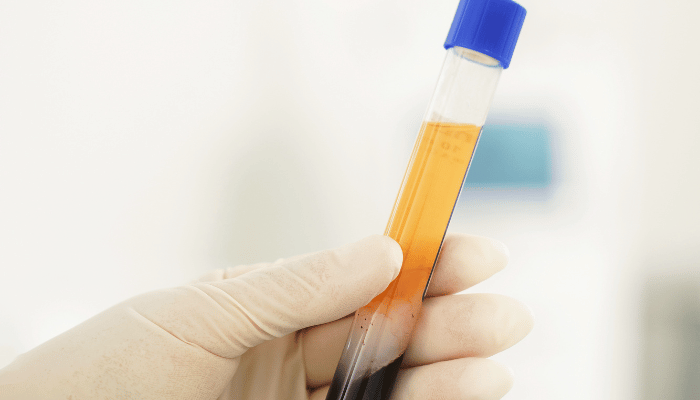 Growth Factor Concentrate (GFC)