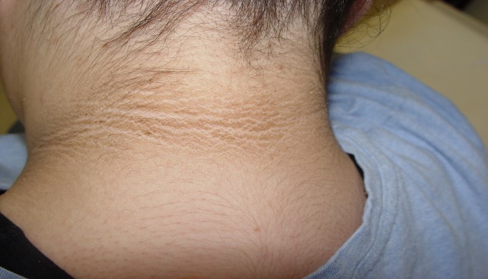 Dark Neck