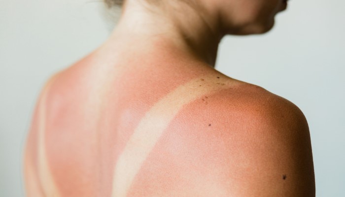 Sun Tan